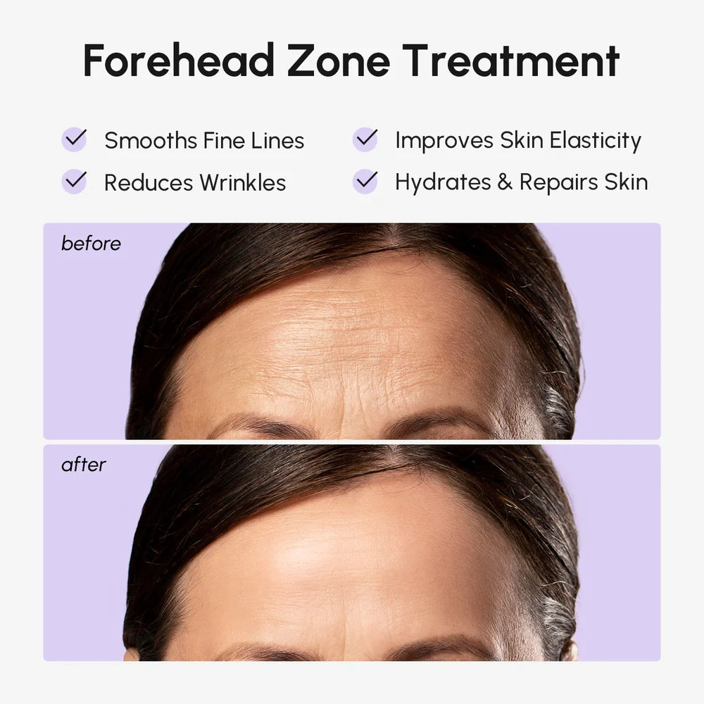 Smoothing Forehead Patches
